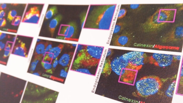 Findings from the BOW project demonstrate promising properties in the extracellular vesicles of microalga Tetraselmis chuii.